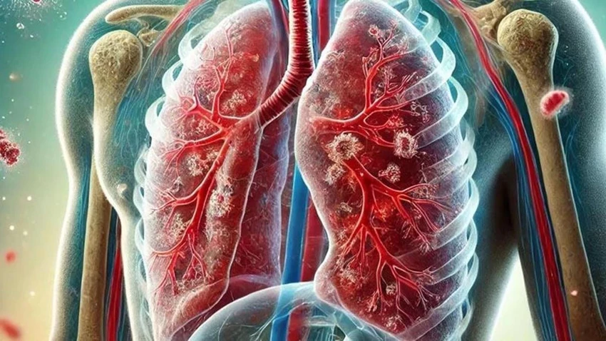 İzmir İl Sağlık Müdürü Doç. Dr. Ayhan Kul, kentte tüberküloz